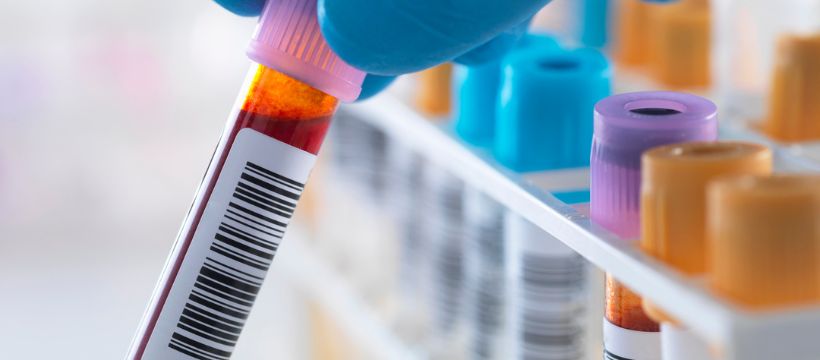 women’s hormone test results