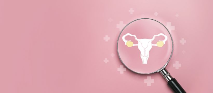 Ovarian Cancer Screening
